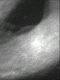 Thumbnail of image