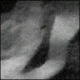 Thumbnail of image